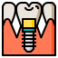 Implant icon 64x64