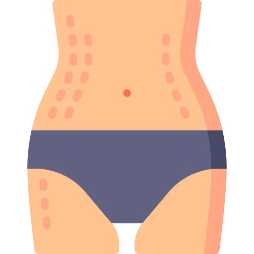 Stretch marks icon