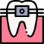 Braces biểu tượng 64x64