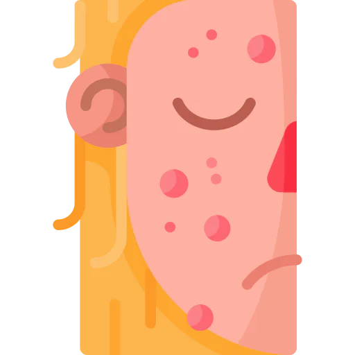 Acne icon