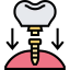 Dental implant Symbol 64x64