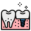 Implant icon 64x64